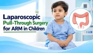 Laparoscopic Pull-Through Surgery for ARM in Children