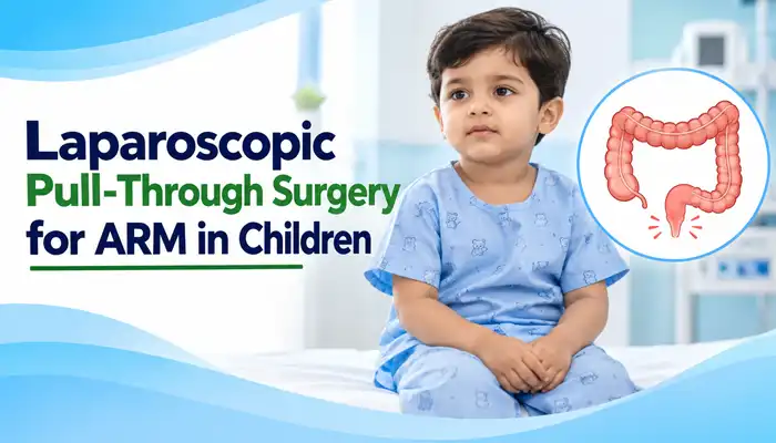 Laparoscopic Pull-Through Surgery for ARM in Children