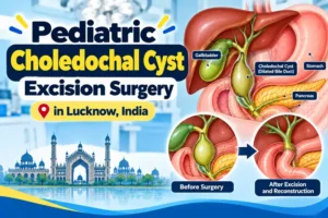 Pediatric Choledochal Cyst Excision