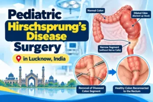 Pediatric Hirschsprung’s Disease Surgery