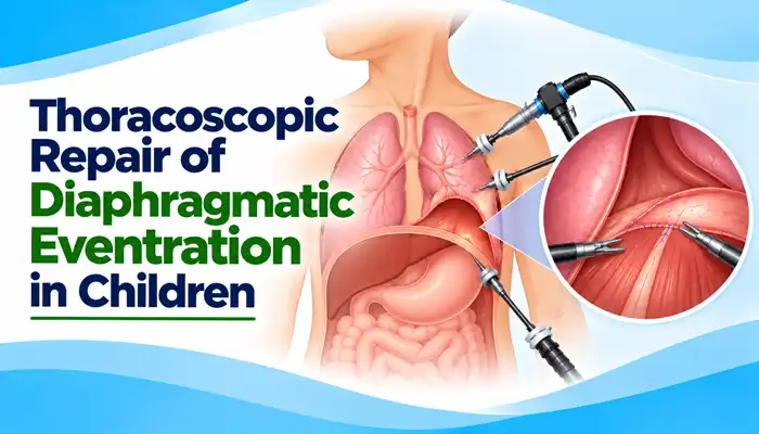 Thoracoscopic Repair of Diaphragmatic Eventration in Children