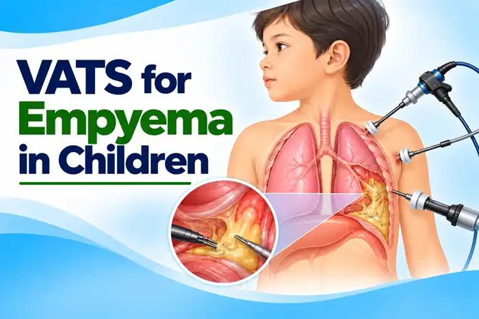 VATS for Empyema in Children